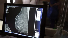 Tecnologia do micro-ondas propõe alternativa mais confortável e acessível à mamografia tradicional