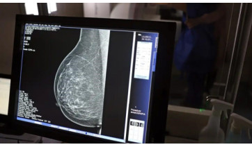 Tecnologia do micro-ondas propõe alternativa mais confortável e acessível à mamografia tradicional