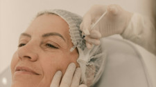 FAI abre inscrições para procedimentos estéticos de harmonização facial e corporal