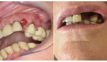 Professora é ferida em sala de aula após episódio de agressividade de aluno em Flórida Paulista