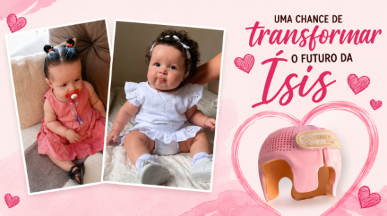 Família promove campanha para custear capacete ortopédico para bebê de 11 meses em Adamantina