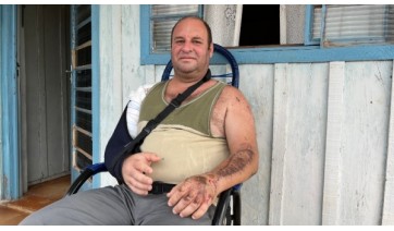 Gravemente ferido em acidente entre moto e nibus, servidor pblico se recupera e faz agradecimentos