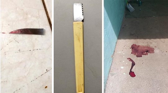 Homem usou faca para atacar mulher, causando ferimentos graves na altura do pescoço (Fotos: João Mário Trentini/Bastos Já).