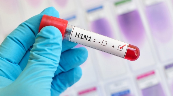Casos de H1N1 em Osvaldo Cruz deixam autoridades de saúde em alerta (Reprodução).