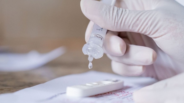 Teste passa a ser coberto para os beneficiários de planos de saúde com segmentação ambulatorial, hospitalar ou referência (Foto: Myke Sena/MS).