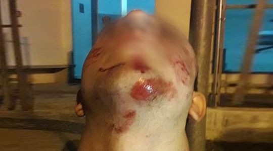 Rapaz de 25 anos agredido na cabeça e em todo o corpo disse que violência teve motivação homofóbica (Imagens: Acervo Pessoal).