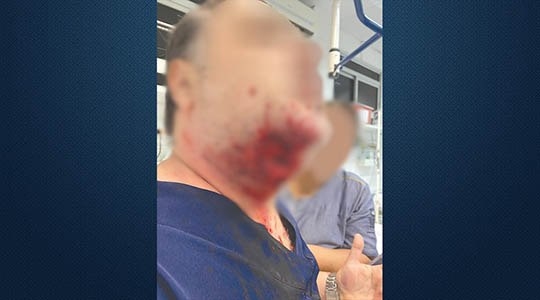 Médico foi mordido no pescoço por um paciente dentro da Santa Casa de Araçatuba (Foto: Acervo Pessoal).