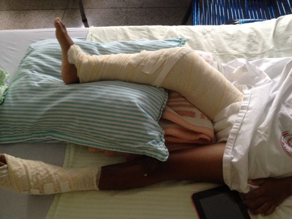 Criança ferida em acidente teve alta e passa a fazer recuperação em casa (Foto: Cedida/Jorbes Daniel).