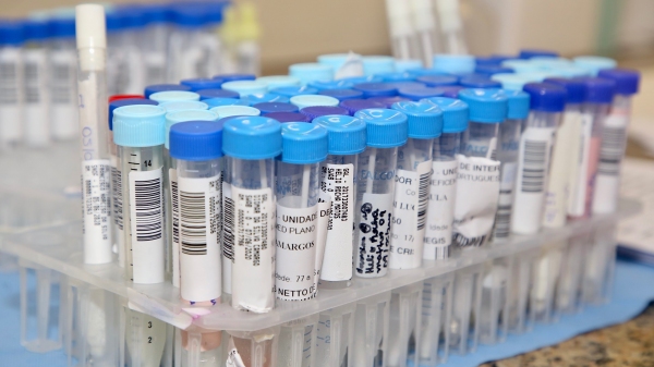 ANS retira teste para Covid-19 de lista obrigatória de cobertura dos planos de saúde