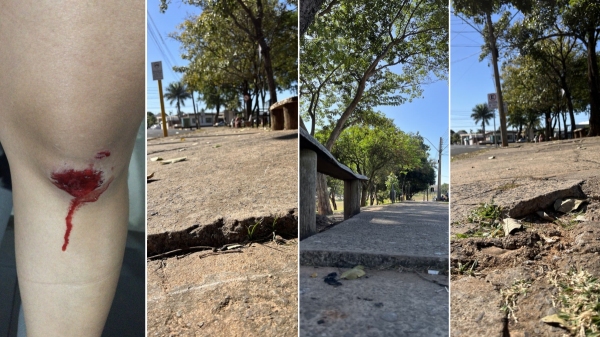 Moradora com joelho ferido após queda em calçada com falhas e desníveis, no Parque dos Pioneiros (Imagens: Cedida e Siga Mais).
