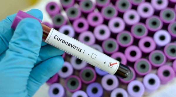 Covid-19: mortes sobem para 11 e casos confirmados chegam a 904