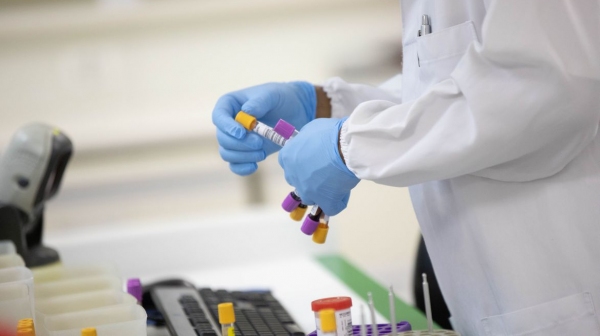 Segundo o Ministério da Saúde, foi a primeira vez em que as duas curvas apresentaram uma redução acima de 10% juntas desde o início da pandemia (Foto: Gov/SP).