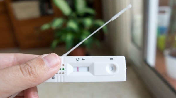 O teste deve ser realizado entre o 1º e 7º dia do início do sintoma, ou 5 dias depois de contato com uma pessoa infectada com o novo coronavírus (Reprodução).