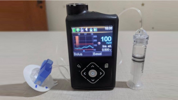 Dispositivo automatizado para monitoramento da glicemia e injeção de insulina no menino, portador de Diabetes Mellitus Tipo 1 (Cedida).