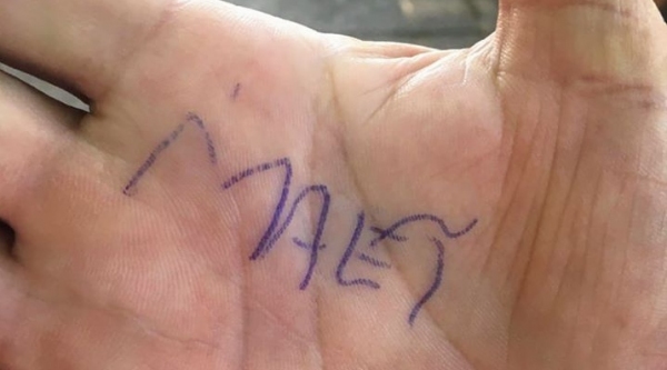 Na palma da mão do pai, a manifestação de recuperação da filha, que escreveu a palavra ?mãe?  (Reprodução).