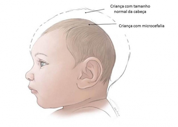 Imagem: Ilustração