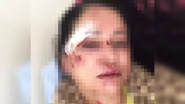 A mulher vítima da agressão (Reprodução).