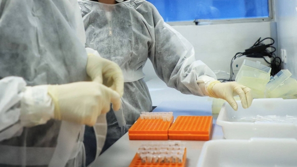 Sem o sequenciamento genético a partir das amostras biológicas positivas para Covid-19 não dá para saber sobre a ocorrência da variante Delta (Jose Fernando Ogura/AEN).