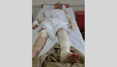 Dr. Pacheco recupera-se de acidente e deve manter-se no cargo (Foto: Arquivo Pessoal/Facebook).