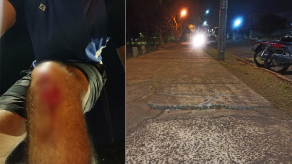 Morador se feriu na sexta-feira (29) após queda por falhas no passeio público, no Parque dos Pioneiros. Foi a terceira vez que acontece com ele (Cedida).
