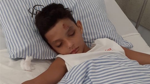 Na Santa Casa de Adamantina, menino de 10 anos se recupera do atropelamento (Foto: Cedida).
