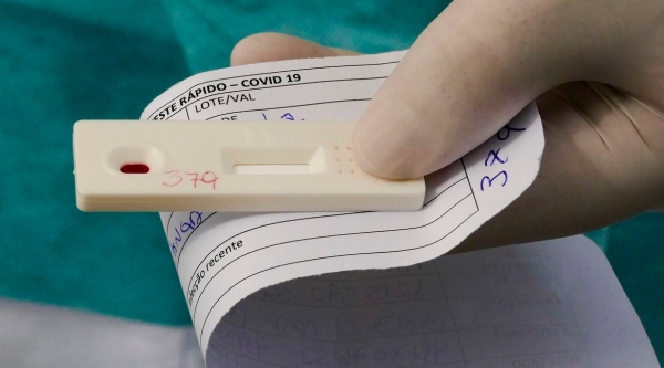 O exame diagnóstico previsto pela ANS é o do tipo pesquisa por RT ? PCR, com diretriz de utilização, e deve ser feito em pacientes considerados quadro suspeito ou provável da doença, de acordo com a indicação médica (Foto: Leopoldo Silva/Agência Senado).