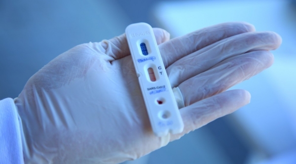 Teste rápido de coronavírus poderá ser realizado em farmácias (Foto: Leonardo Sousa/PMF).