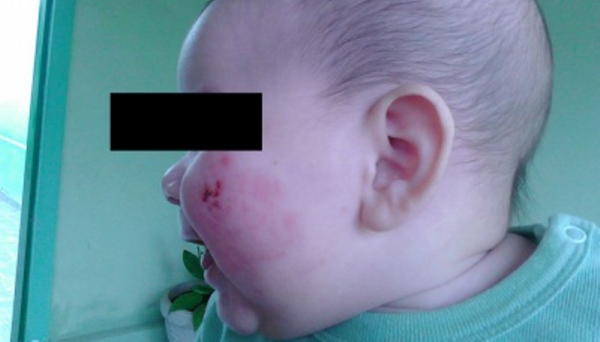 Criança ficou com ferimentos, aparentemente de mordidas. Mão procurou Delegacia de Defesa da Mulher para denunciar o caso (Fotos:  Cristiano Nascimento/Site OCNews).