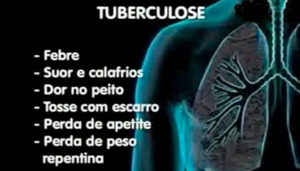 Saúde faz ações em busca por sintomáticos de tuberculose