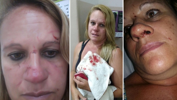 A faxineira Simone Nunes foi agredida por casal, em discussão, na noite do Dia Internacional da Mulher (Foto: Cedida).