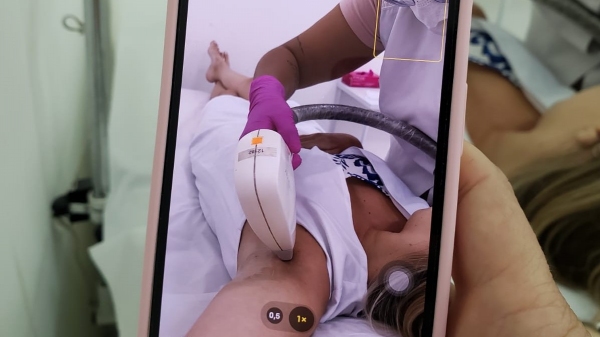 Depilação a laser atende mulheres e homens no Laser Day, Adamantina (Divulgação).